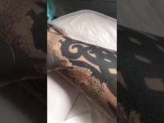 μηχανή λέιζερ pico δεύτερη για την αφαίρεση δερματοστιξιών